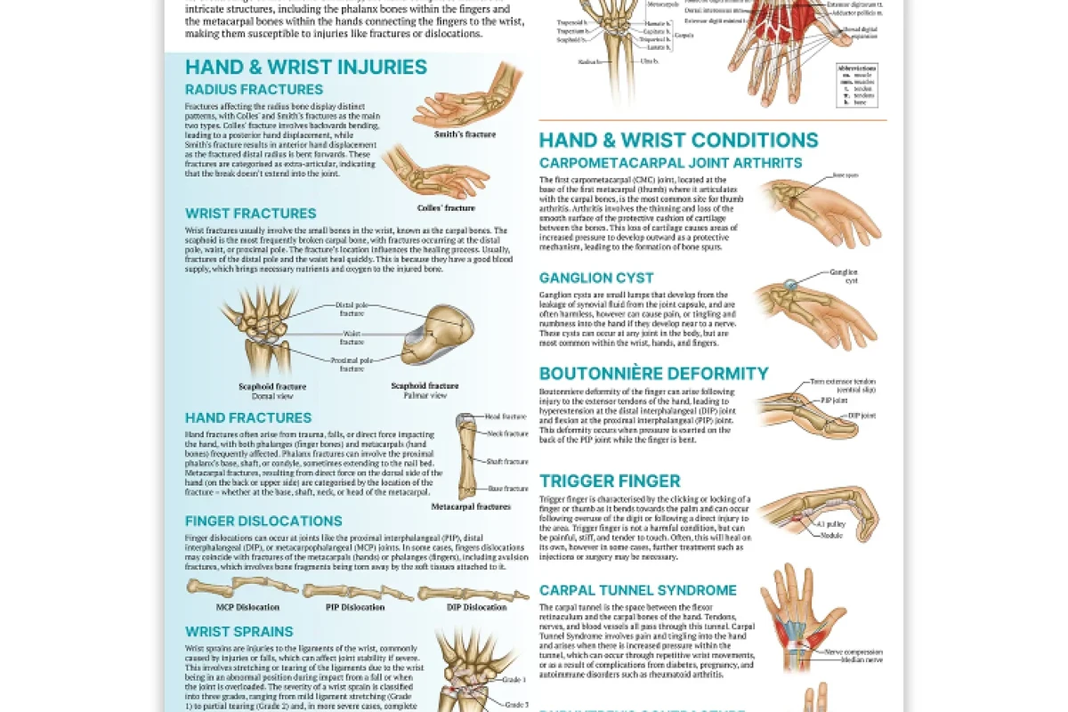 How to Prevent Wrist Pain from Typing for Comfortable in the UAE
